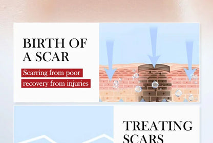 SADOER Scar Repair Cream