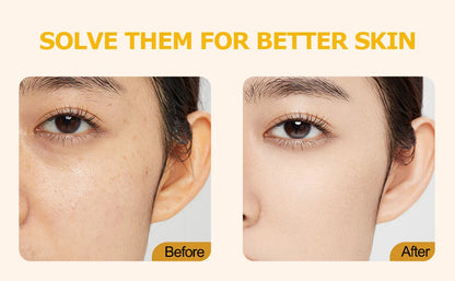 Solva Face Moisturizer