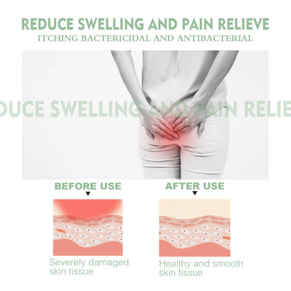 Solva Hemorrhoid Cream