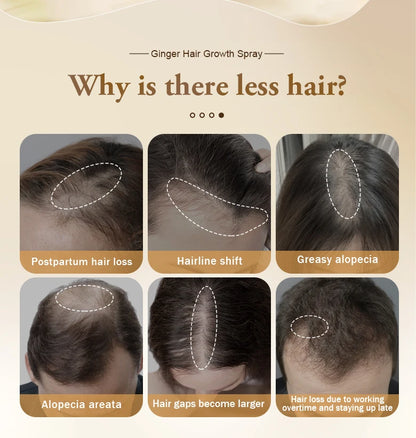 PURC Fast Ginger Hair Growth Spray