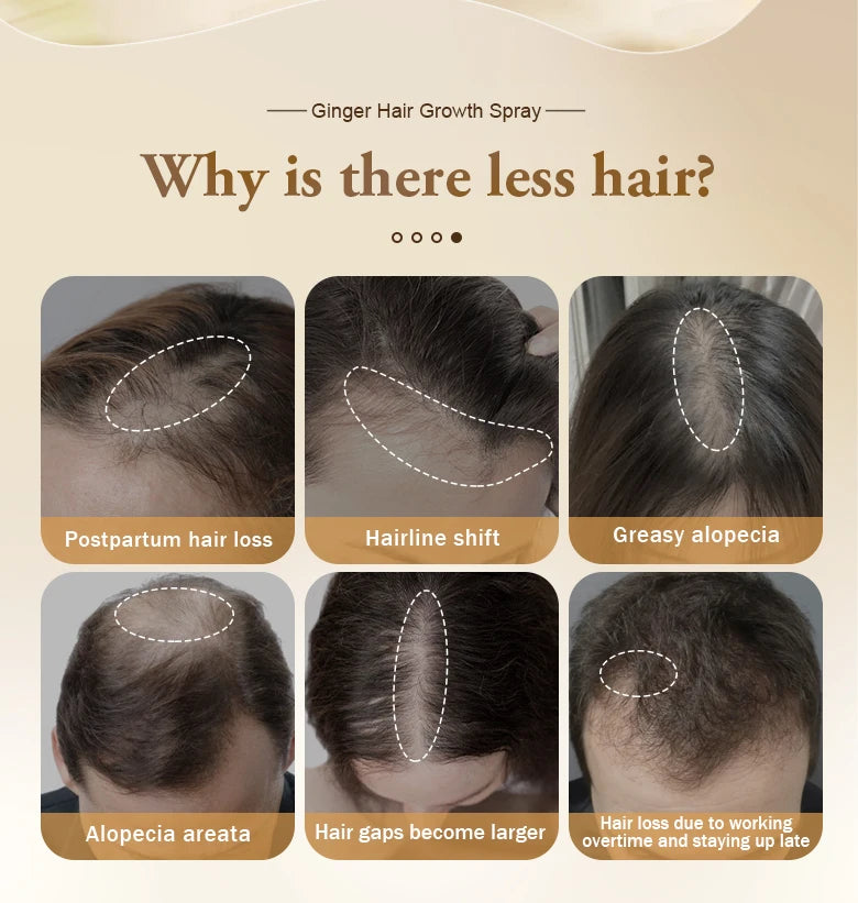 PURC Fast Ginger Hair Growth Spray,