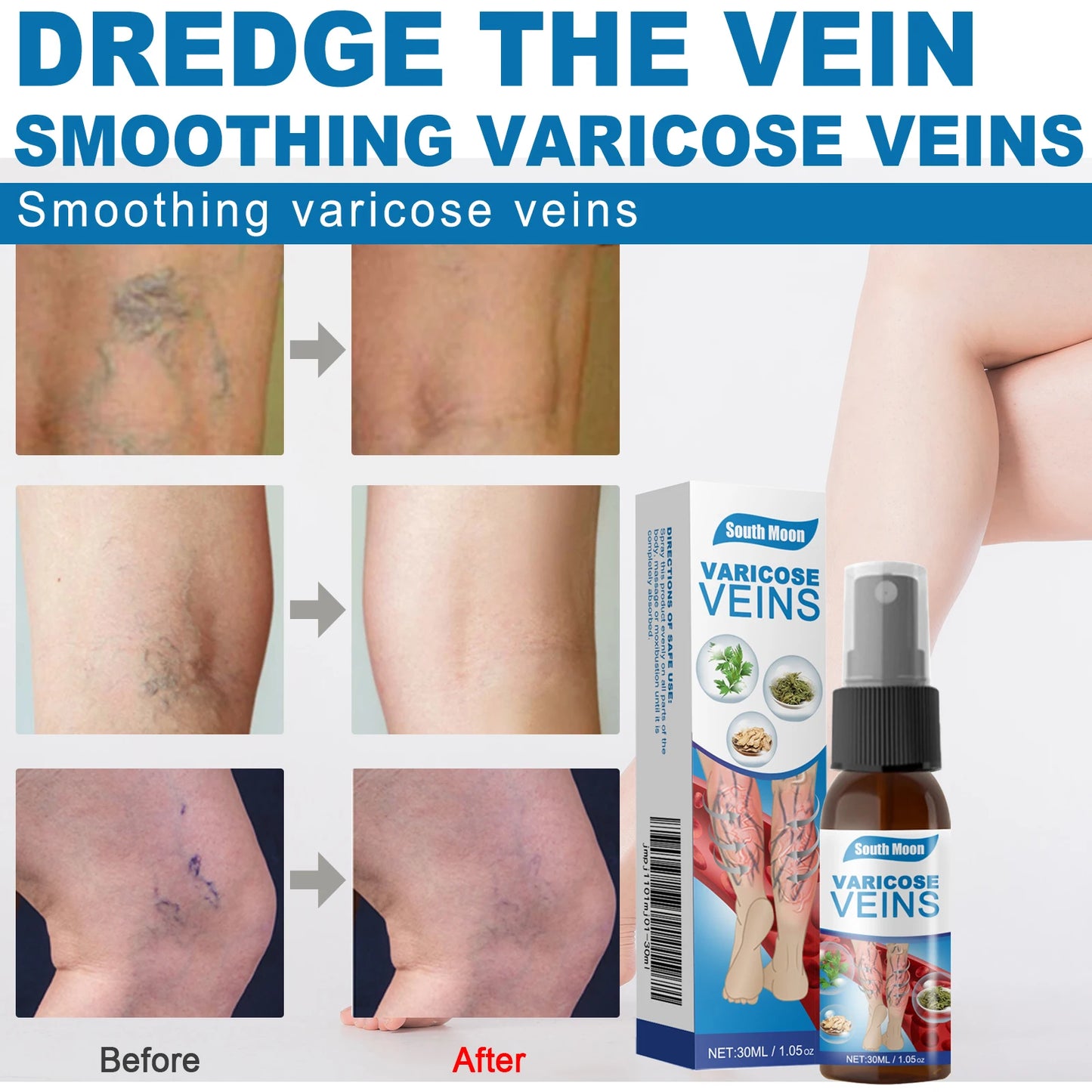 Solva™ Varicose Vein Spray
